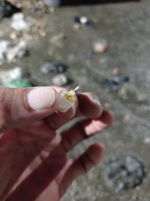 Una aguja mal dispuesta dejó a una operaria de EEPP de La Ceja lesionada en una mano